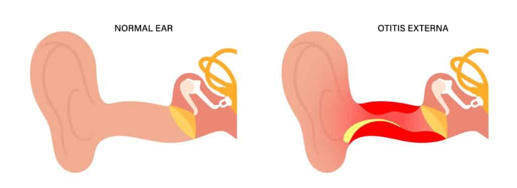 Why You Should Use Ear Plugs For Swimming | House of Hearing